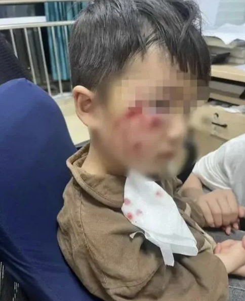 被瘋?cè)麤](méi)有“救命藥”，怎么辦？